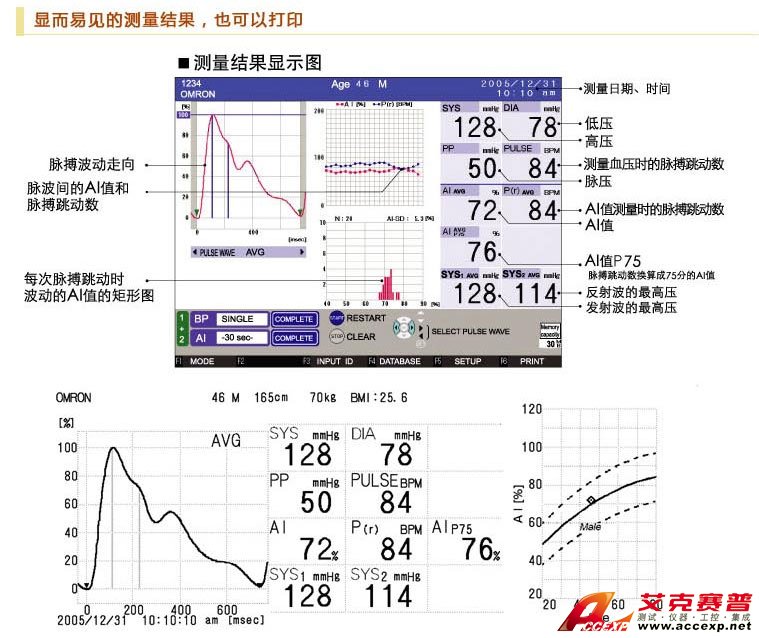 顯而易見的動(dòng)脈結(jié)果